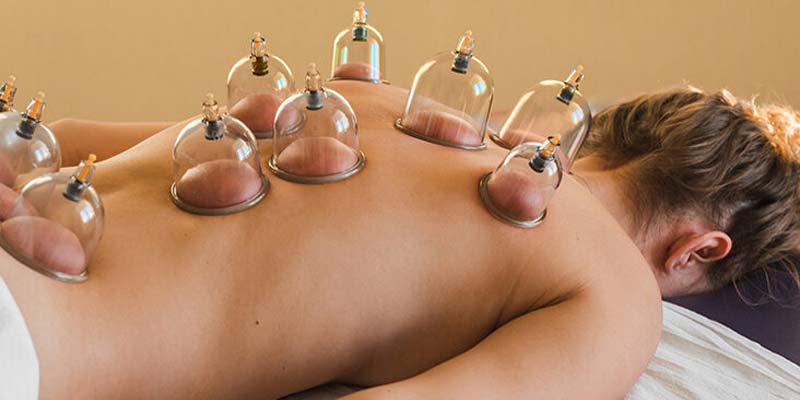 Cupping Therapy for Hair Problems  PRP Treatment center